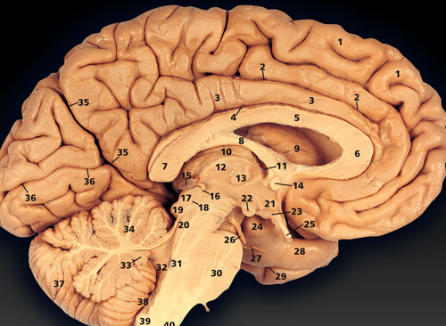 Sectioned Brain Photo