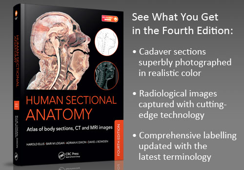 Human Sectional Anatomy: Atlas of Body Sections, CT and MRI Images, Fourth Edition