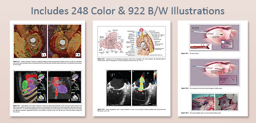 Includes 248 Color and 922 B/W Illustrations