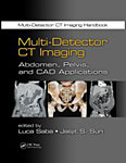 Multi-Detector CT Imaging: Abdomen, Pelvis, and CAD Applications